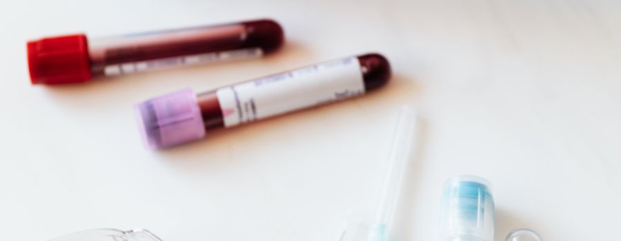 Syringes and test tubes on table in laboratory